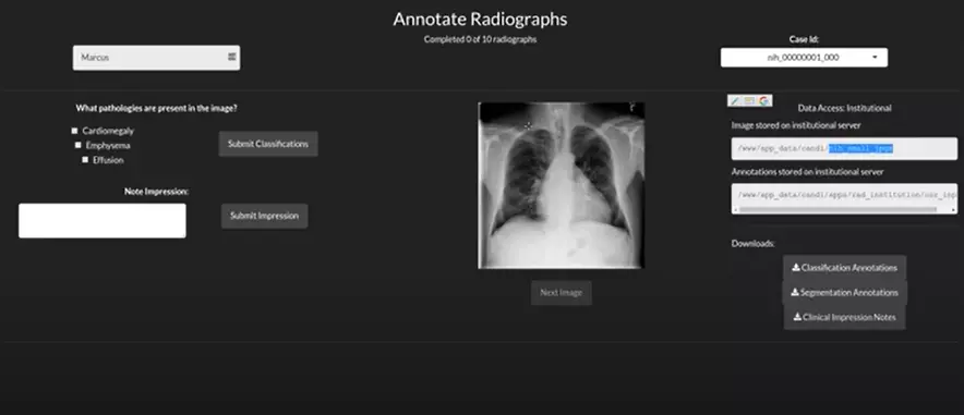 machine learning annotation of radiographs using r shiny